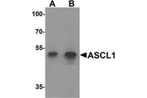 Western blot analysis of ACSL1 in human lung tissue lysate with ACSL1 Antibody  at (A) 1 and (B) 2 μg/ml.