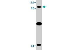 Western blot analysis of TLR6 expression in Jurkat cell lysate with TLR6 polyclonal antibody  at 2 ug/mL .