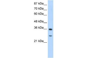 WB Suggested Anti-GIPC2 Antibody Titration:  1. (GIPC2 Antikörper  (N-Term))