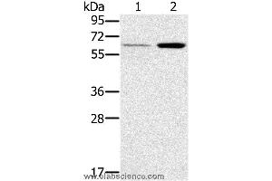 Western blot analysis of Human liver and mouse kidney tissue, using TNFRSF11A Polyclonal Antibody at dilution of 1:200 (TNFRSF11A Antikörper)