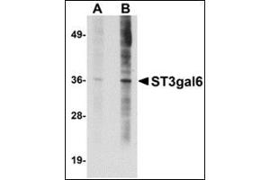 Western blot analysis of ST3gal6 in HeLa cell lysate with this product at (A) 1 and (B) 2 μg/ml.