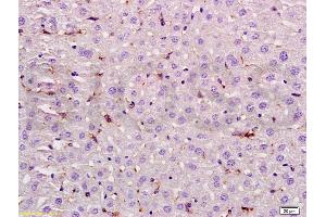 Formalin-fixed and paraffin embedded rat liver labeled with Rabbit Anti LIF Polyclonal Antibody, Unconjugated (ABIN737046) at 1:200 followed by conjugation to the secondary antibody and DAB staining (LIF Antikörper  (AA 101-202))
