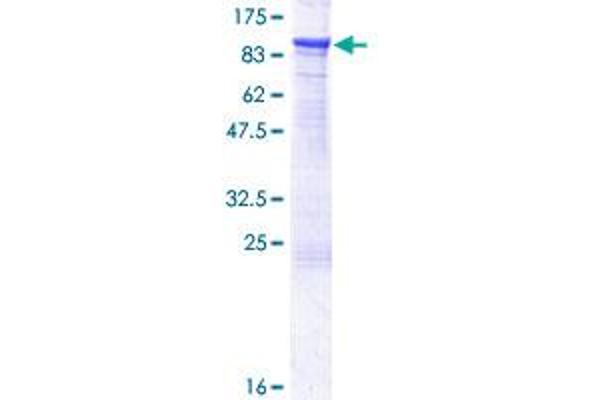 CTNNAL1 Protein (AA 1-734) (GST tag)
