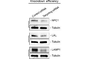 Immunoblots showing knockdown efficiency of siRNA transfections related to Figure 3A. (Lipase A Antikörper  (Center))