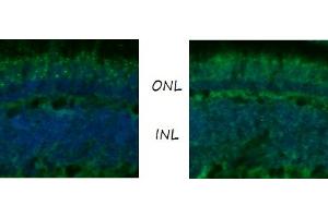 anti-G-Protein Coupled Receptor 98 (ADGRV1) antibody