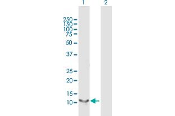 Retinol Binding Protein 5 Antikörper  (AA 1-135)