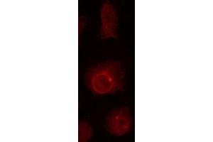 ABIN6267023 staining HuvEc by IF/ICC. (Nibrin Antikörper  (pSer278))