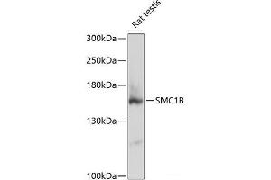 Western blot analysis of extracts of Rat testis using SMC1B Polyclonal Antibody at dilution of 1:3000.