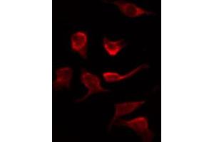 ABIN6267279 staining Hela by IF/ICC.