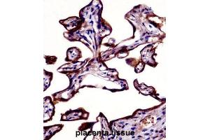 Immunohistochemistry (IHC) image for anti-Placental Alkaline Phosphatase (ALPP) antibody (ABIN2998362) (PLAP Antikörper)