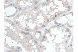 IHC-P analysis of Human Kidney Tissue, with DAB staining. (COQ6 Antikörper  (AA 1-468))