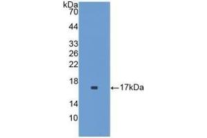 Detection of Recombinant IL1F9, Mouse using Polyclonal Antibody to Interleukin 1 Family, Member 9 (IL1F9) (IL1F9 Antikörper  (AA 5-149))