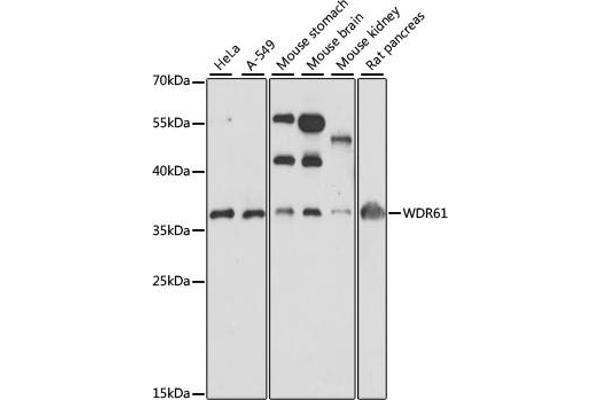 WDR61 Antikörper  (AA 1-305)