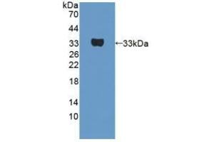 Detection of Recombinant UTRN, Human using Polyclonal Antibody to Utrophin (UTRN) (Utrophin Antikörper  (AA 1-252))