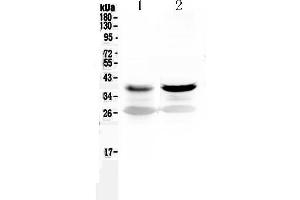 Western blot analysis of MEK6 using anti-MEK6 antibody . (MAP2K6 Antikörper  (AA 280-334))