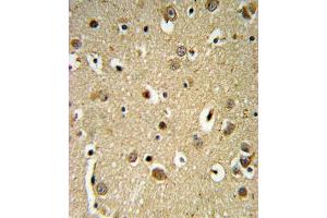 Immunohistochemistry (Paraffin-embedded Sections) (IHC (p)) image for anti-Sprouty RTK Signaling Antagonist 4 (SPRY4) (AA 26-56) antibody (ABIN652338)