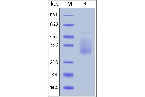 SDS-PAGE (SDS) image for Hepatitis A Virus Cellular Receptor 2 (TIM 3) (AA 22-201) (Active) protein (His tag) (ABIN6809968)