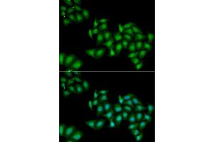 Immunofluorescence (IF) image for anti-DEAD (Asp-Glu-Ala-Asp) Box Polypeptide 1 (DDX1) antibody (ABIN1980256) (DDX1 Antikörper)