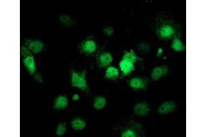 Image no. 3 for anti-Cyclin-Dependent Kinase Inhibitor 3 (CDKN3) antibody (ABIN1497457) (CDKN3 Antikörper)