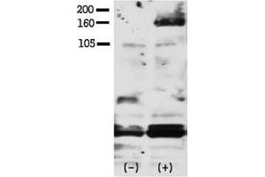 Western blot testing of phospho-HER4 antibody and FG pancreatic carcinoma cells treated with or without EGF (50ng/ml) for 15 min. (ERBB4 Antikörper  (pTyr1188))