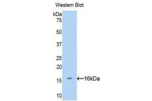 Western Blotting (WB) image for anti-serpin Peptidase Inhibitor, Clade A (Alpha-1 Antiproteinase, Antitrypsin), Member 6 (SERPINA6) (AA 280-405) antibody (ABIN1858268) (SERPINA6 Antikörper  (AA 280-405))