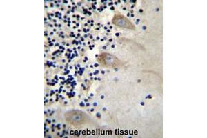 Immunohistochemistry (Paraffin-embedded Sections) (IHC (p)) image for anti-Eukaryotic Translation Initiation Factor 3 Subunit C (EIF3C) (AA 126-155), (N-Term) antibody (ABIN952048)