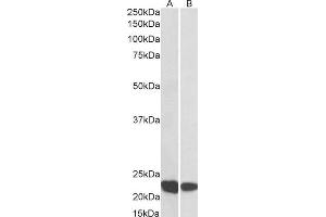 ABIN2564848 (0. (RAC2 Antikörper  (C-Term))