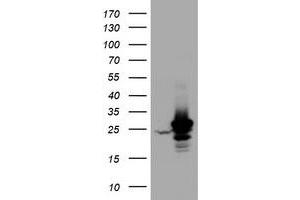 Western Blotting (WB) image for anti-Hydroxysteroid (17-Beta) Dehydrogenase 8 (HSD17B8) (AA 57-261) antibody (ABIN2715557) (HSD17B8 Antikörper  (AA 57-261))