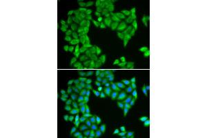 Immunofluorescence analysis of HeLa cells using SPAG5 antibody (ABIN5973851).