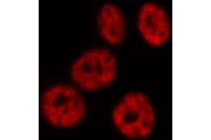 ABIN6267596 staining HeLa by IF/ICC.