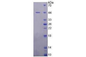 Image no. 1 for Mdm2, p53 E3 Ubiquitin Protein Ligase Homolog (Mouse) (MDM2) (AA 1-218) (Active) protein (His tag) (ABIN6239916) (MDM2 Protein (AA 1-218) (His tag))