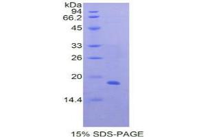 SDS-PAGE analysis of Human Periostin Protein.