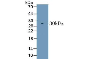 Detection of Recombinant CD226, Human using Monoclonal Antibody to Cluster Of Differentiation 226 (CD226)