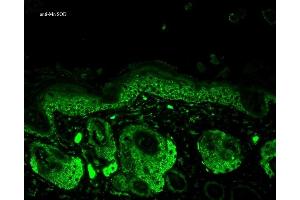 Immunohistochemistry (IHC) image for anti-Superoxide Dismutase 2, Mitochondrial (SOD2) antibody (ABIN361656)
