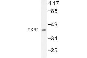 Image no. 1 for anti-Protein Kinase, CAMP-Dependent, Regulatory, Type I, alpha (Tissue Specific Extinguisher 1) (PRKAR1A) antibody (ABIN317770) (PRKAR1A Antikörper)
