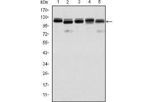 Western blot analysis using BMPR2 mouse mAb against Hela (1), A431 (2), NIH/3T3 (3), Cos7 (4) and PC-12 (5) cell lysate. (BMPR2 Antikörper)