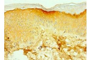 Immunohistochemistry of paraffin-embedded human skin tissue using ABIN7171754 at dilution of 1:100 (TNXB Antikörper  (AA 3933-4242))