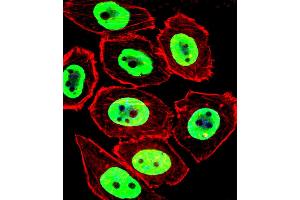 Fluorescent confocal image of U251 cell stained with EWSR1 Antibody . (EWSR1 Antikörper  (C-Term))