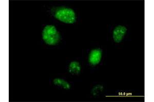 Immunofluorescence of purified MaxPab antibody to LOC148203 on HeLa cell. (ZNF738 Antikörper  (AA 1-137))