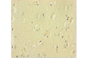 Immunohistochemistry of paraffin-embedded human brain tissue using ABIN7153507 at dilution of 1:100 (GABRQ Antikörper  (AA 348-611))