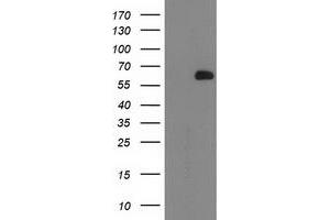Western Blotting (WB) image for anti-2-Oxoglutarate and Iron-Dependent Oxygenase Domain Containing 1 (OGFOD1) antibody (ABIN1499912) (OGFOD1 Antikörper)