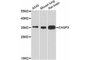 Western blot analysis of extracts of various cell lines, using CASP3 antibody (ABIN5970047) at 1/1000 dilution.