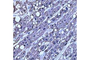 IHC analysis of TRAM1L1 using anti-TRAM1L1 antibody (ABIN7602939). (TRAM1L1 Antikörper  (C-Term))