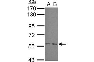 Western Blotting (WB) image for anti-ADP-Ribosylation Factor GTPase Activating Protein 3 (ARFGAP3) (N-Term) antibody (ABIN1493987)