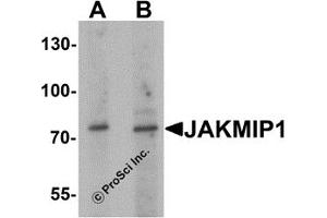 Western Blotting (WB) image for anti-Janus Kinase and Microtubule Interacting Protein 1 (JAKMIP1) antibody (ABIN1077419) (JAKMIP1 Antikörper)