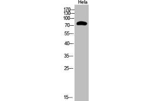 Western Blot analysis of Hela cells using Acetyl-Ub (K48) Polyclonal Antibody (UBA52/RPS27A/UBB/UBC (acLys48) Antikörper)