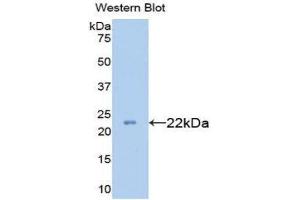 Western Blotting (WB) image for anti-Collagen, Type XVIII (COL18) (AA 1591-1774) antibody (ABIN1077946) (COL18 Antikörper  (AA 1591-1774))