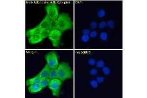 ABIN185477 Immunofluorescence analysis of paraformaldehyde fixed A431 cells, permeabilized with 0. (Adenosine A2b Receptor Antikörper  (C-Term))