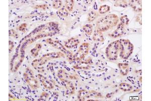 Immunohistochemistry (IHC) image for anti-Sodium Channel, Nonvoltage-Gated 1 alpha (SCNN1A) (AA 201-300) antibody (ABIN682243)