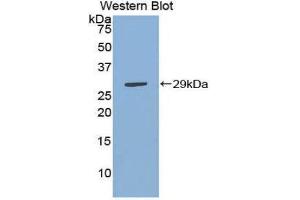Western Blotting (WB) image for anti-Inhibitor of KB Kinase beta Interacting Protein (IKbIP) (AA 78-301) antibody (ABIN1859322) (IKbIP Antikörper  (AA 78-301))